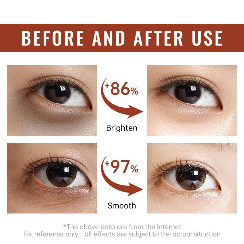 Crème pour les yeux raffermiss - Women Bags Under Eyes avis et prix